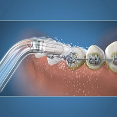Water flosser tip - WATERPIK - Orthodontic - Eliminates dental plaque - Special dental appliances